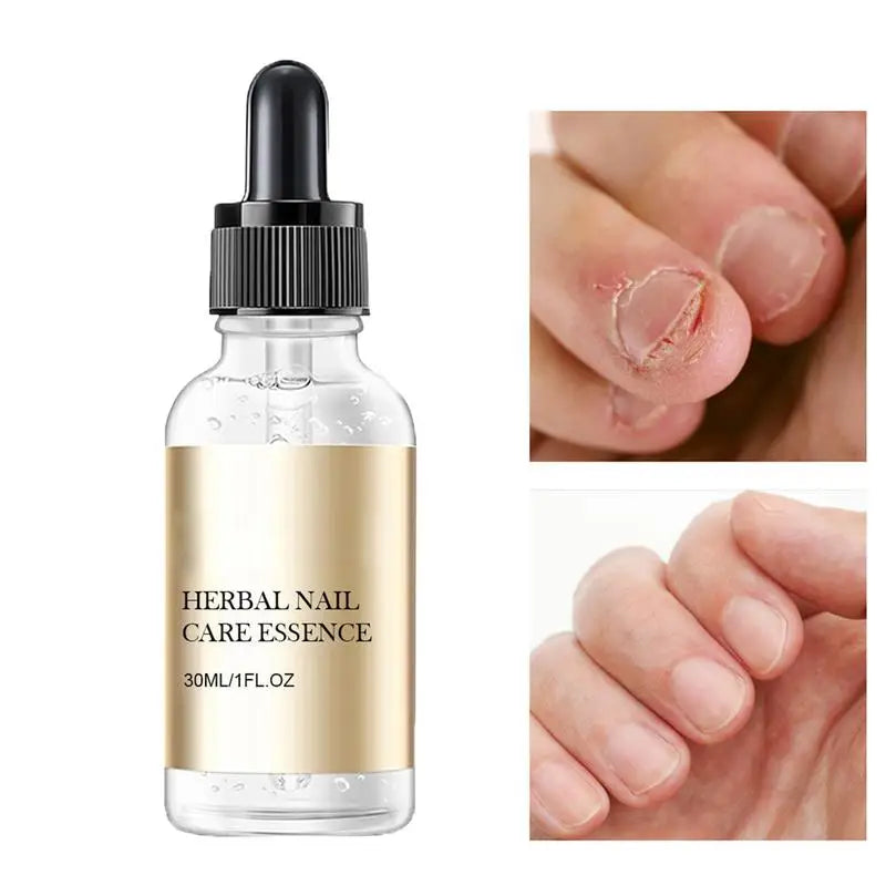 Nail Strengthening Care Essence